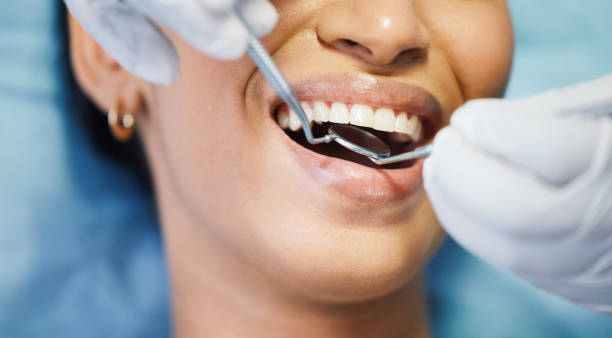Best Emergency Wisdom Teeth Removal in West Buechel, KY